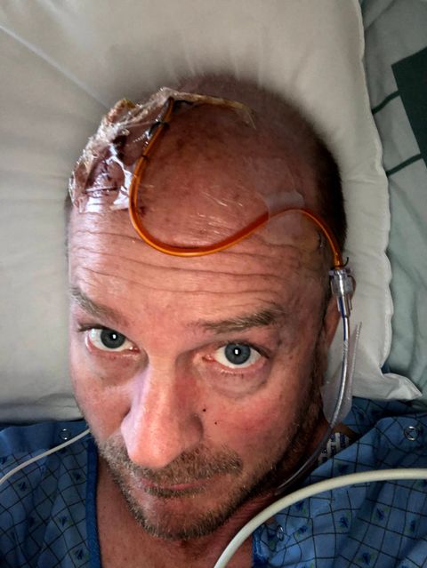 Mike Hawkins in a hospital bed recovering after brain surgery